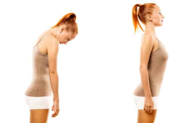 Rounded Shoulders- Tips to Improve Posture 